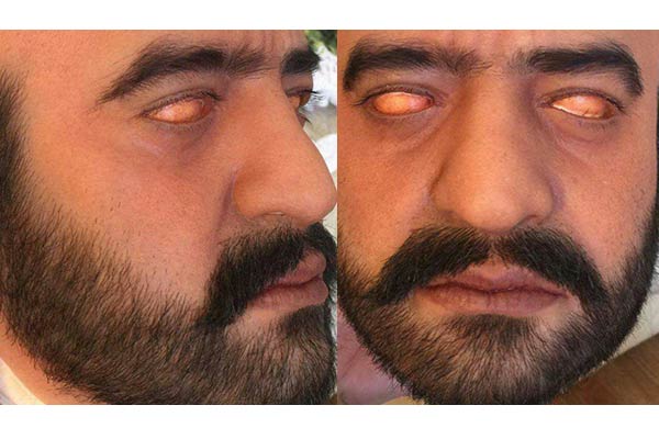 Leaked NTR's prosthetics create a stir