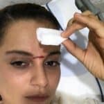 Kangana Ranaut badly Injured on the sets of Manikarnika