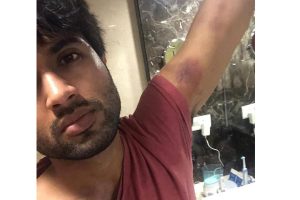 When Vijay Devarakonda’s train stunt went wrong