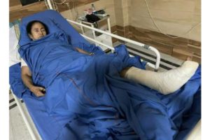 Mamata in hospital with plaster cast on her leg