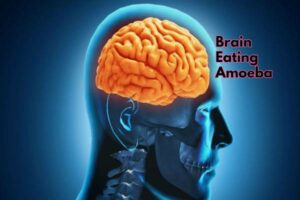 Fifth Case of Deadly Brain-Eating Amoeba Registered