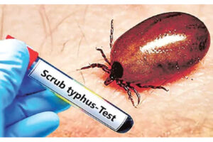 Scrub Typhus in Andhra Pradesh: What It Is, How to Stay Safe, and What the Government Is Doing