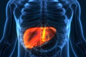 Nearly 4 in 10 Adults in Hyderabad May Have Fatty Liver Disease